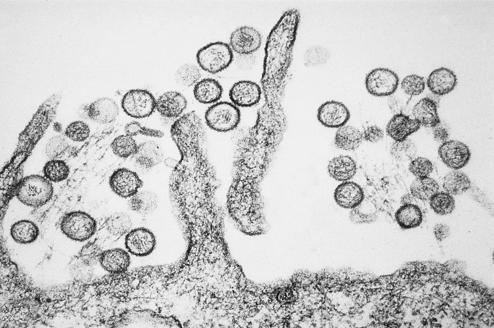 Colorized transmission electron micrograph of Sin Nombre virus particles