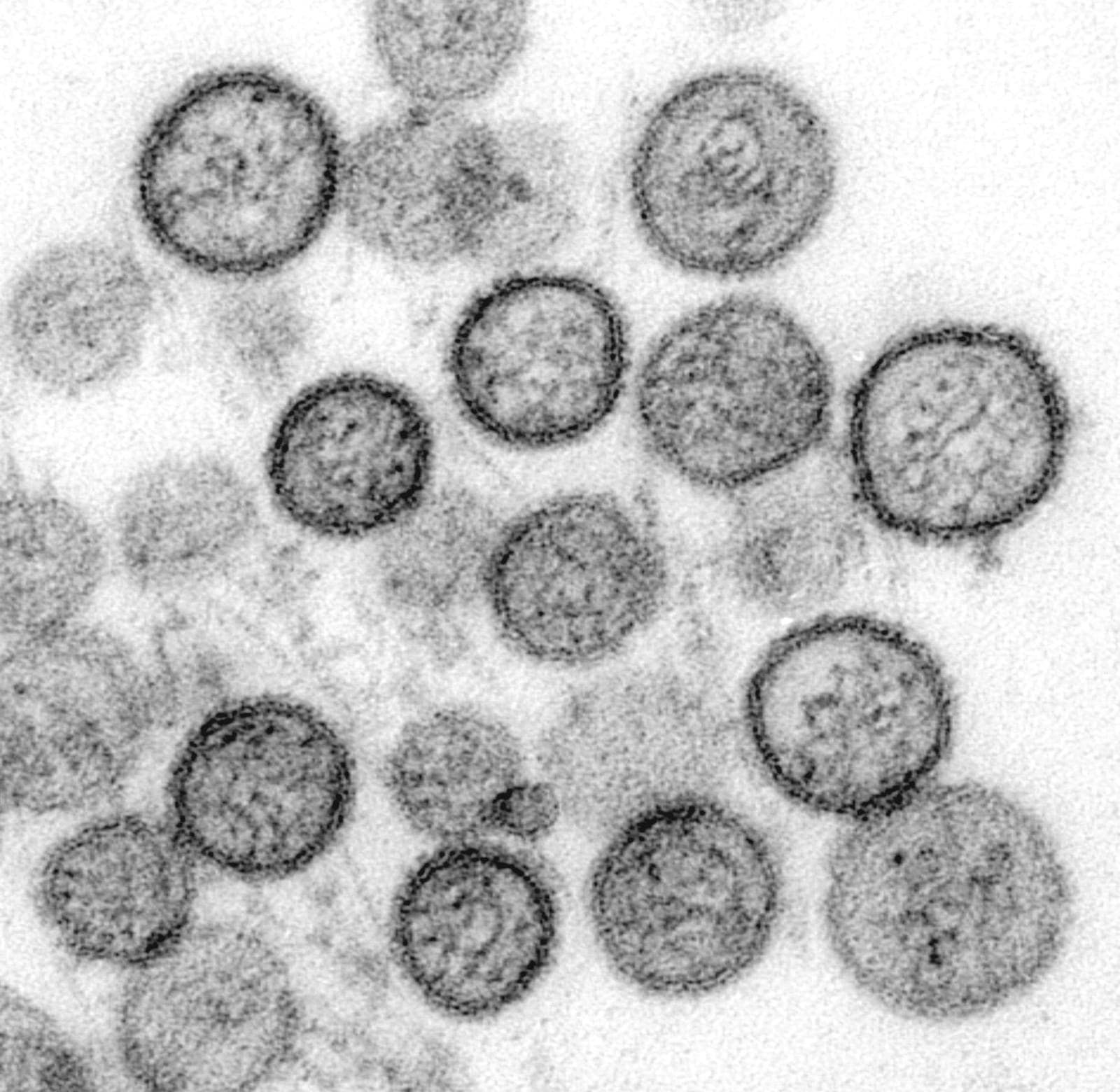 Colorized transmission electron micrograph of Sin Nombre virus particles